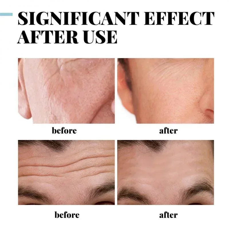 Creme facial hidratante e hidratante com ácido hialurônico para homens