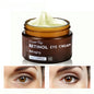 [30g Intensive Anti-Aging Eye] Creme com Retinol e Péptidos para o Cuidado de Olhos Jovens e Radiantes