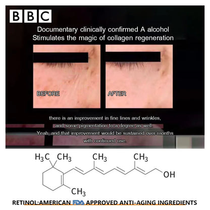 [30g Intensive Anti-Aging Eye] Creme com Retinol e Péptidos para o Cuidado de Olhos Jovens e Radiantes