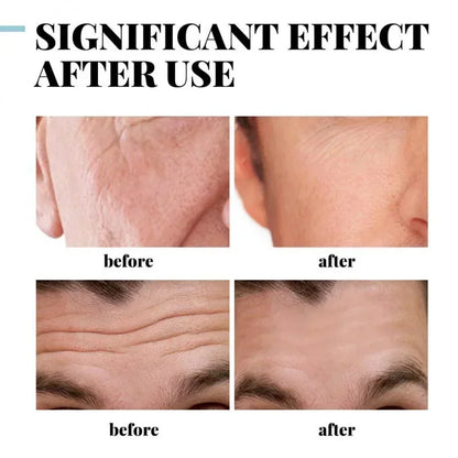 Creme facial hidratante e hidratante com ácido hialurônico para homens